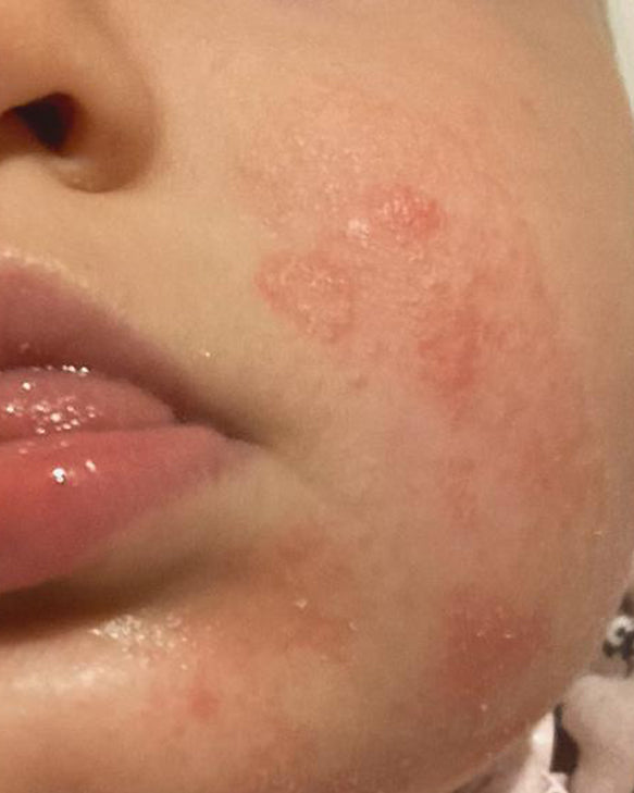 Lilli – Before